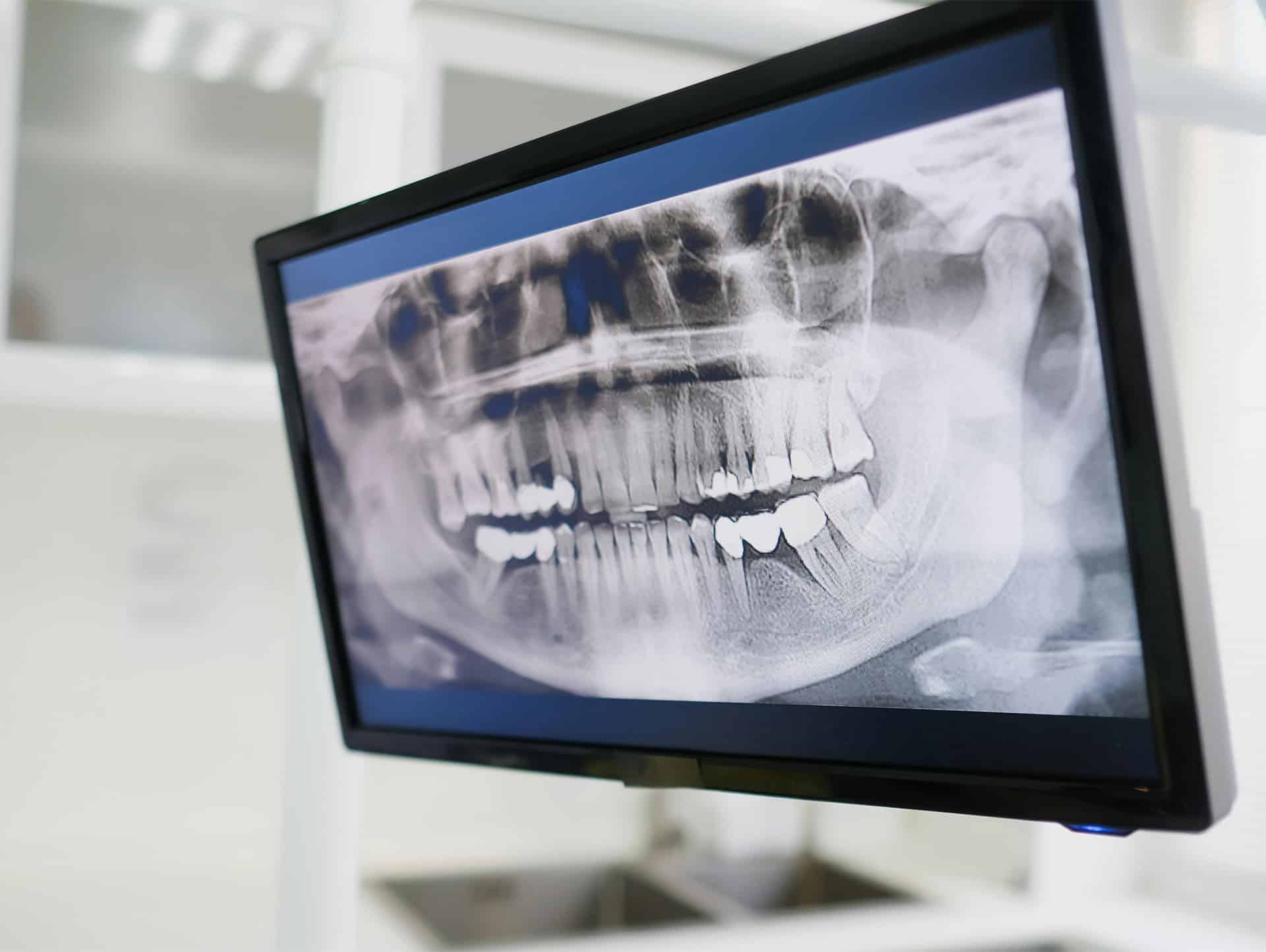 Toma rápida de tomografía dental en Lima