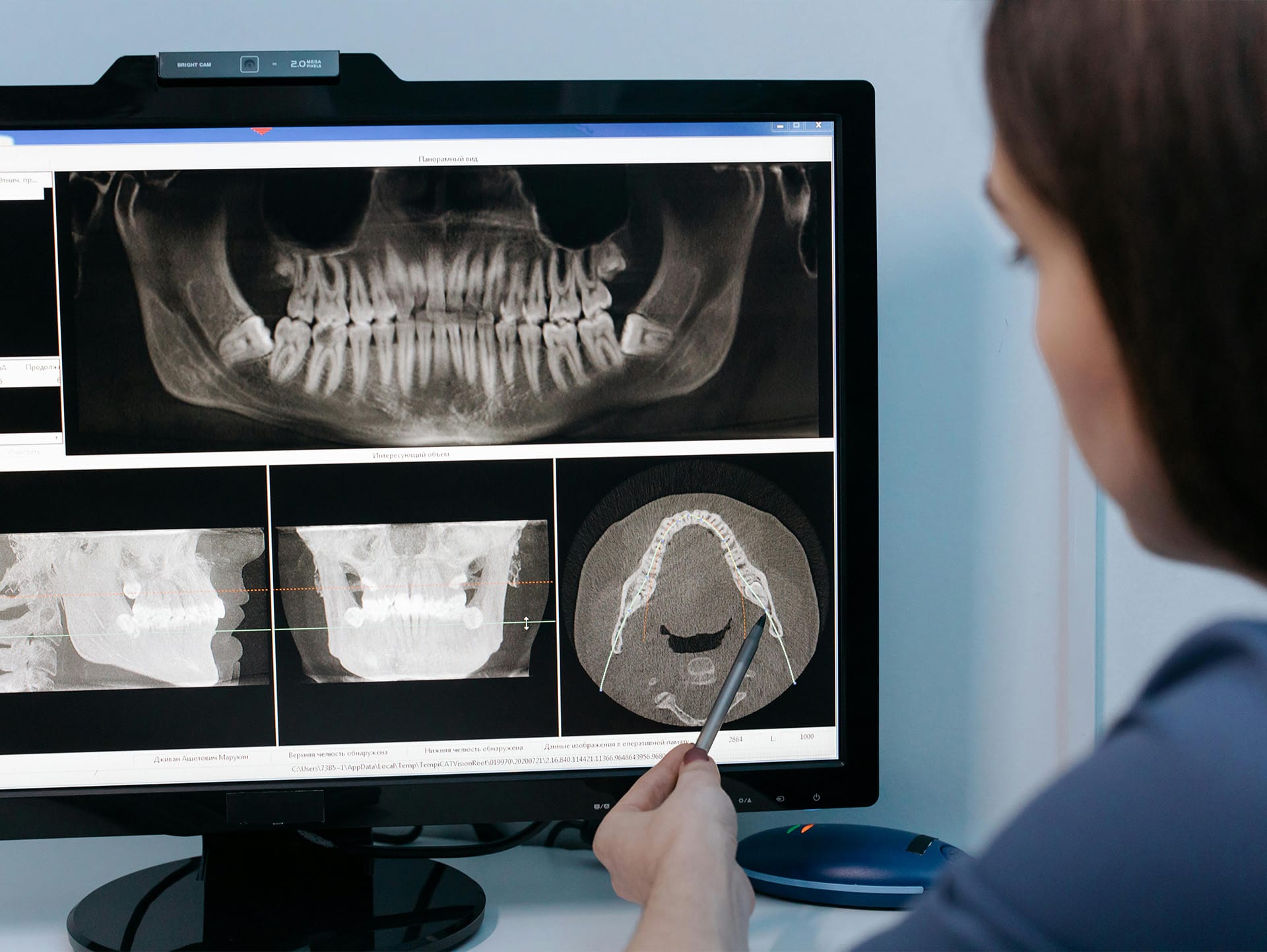 Planificación 3D de implantes dentales en PD Imaging Surco