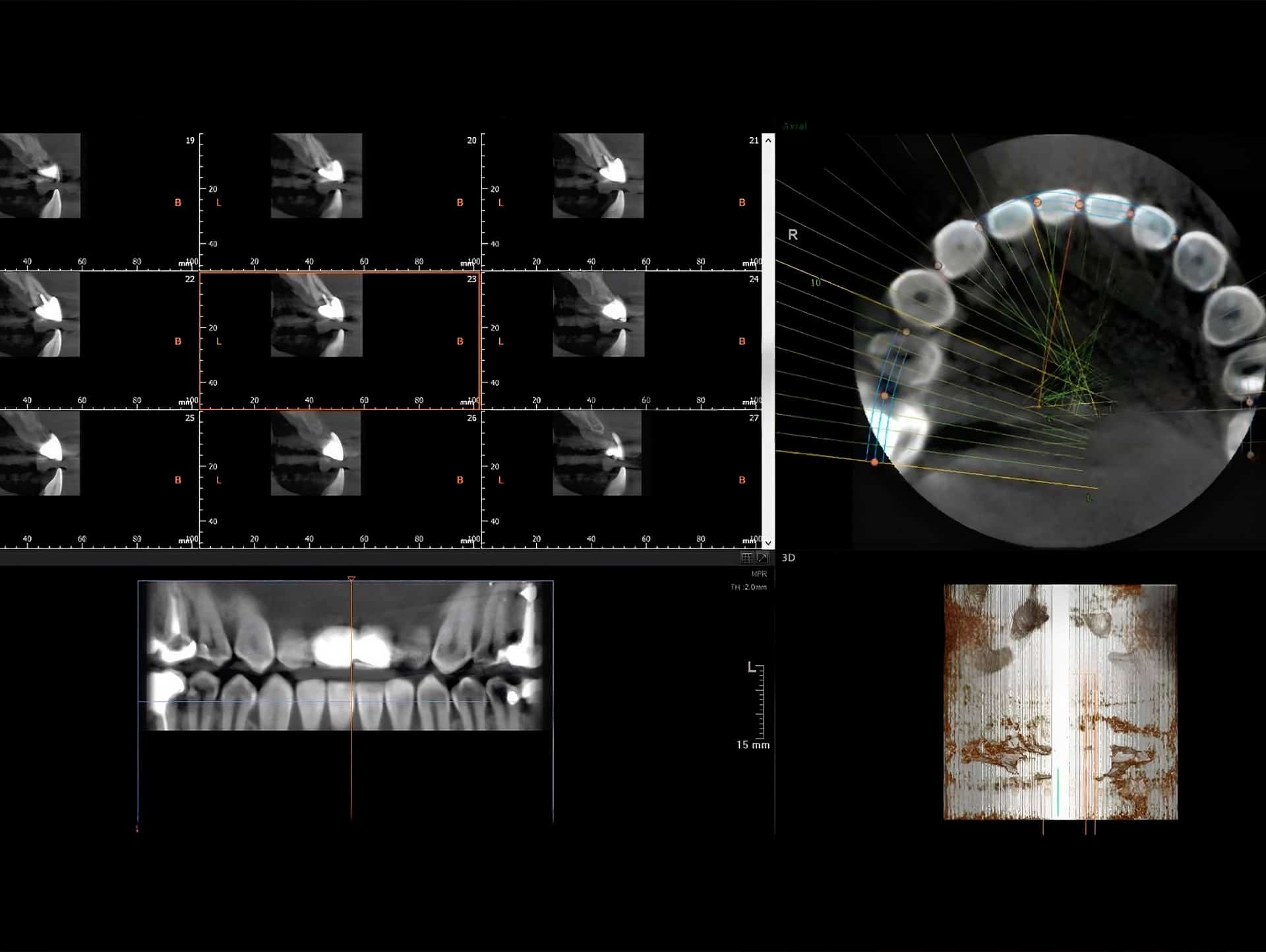 Especialista revisando tomografía cone beam 3D en Lima
